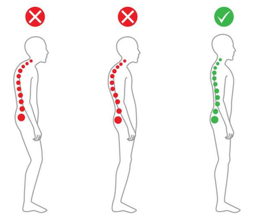 5 ESSENTIAL EXERCISES TO CORRECT YOUR POSTURE | GET RESULTS FAST!
